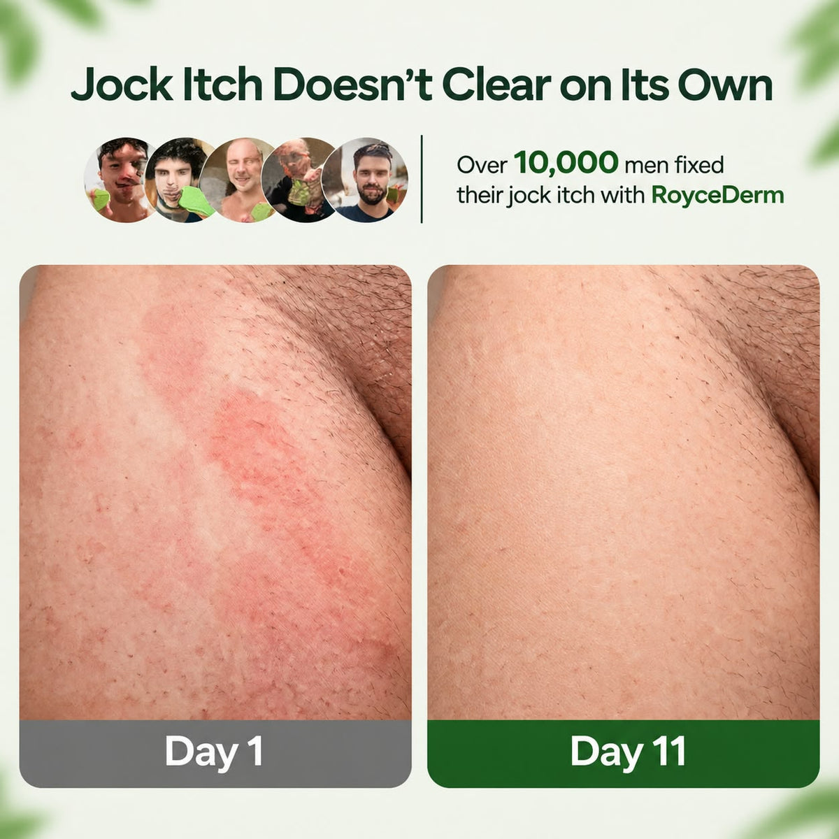 Royce Derm™ Antifungal Soap