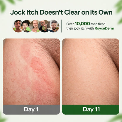 Royce Derm™ Antifungal Soap